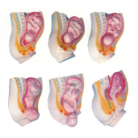 足月胎兒分娩過(guò)程模型